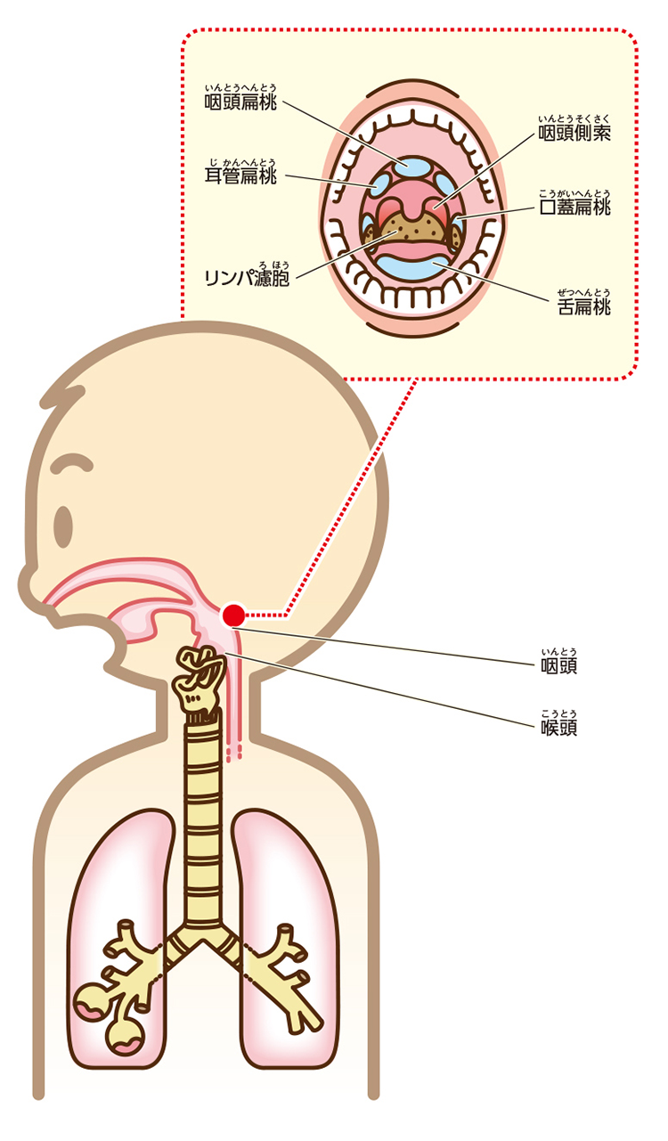 のど 喉 の痛みの原因 症状 疾患ナビ 健康サイト