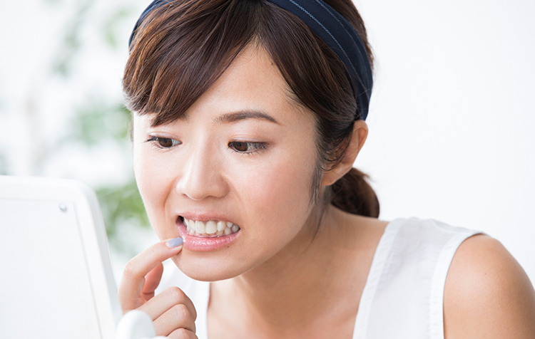口内炎 口唇炎の原因 症状 疾患ナビ 健康サイト