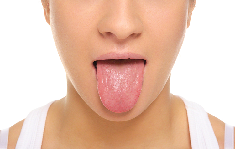 舌の痛み あれの原因 症状 疾患ナビ 健康サイト