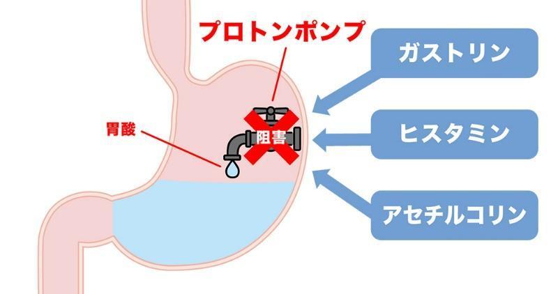 胃もたれや胸やけ、胃痛に対する胃酸分泌を元から抑えるPPI（プロトンポンプ阻害薬）の作用を表す胃の断面のイメージ図