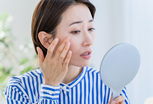 しみ・そばかす・日焼けとは？ それぞれの違いやスキンケア方法を解説
