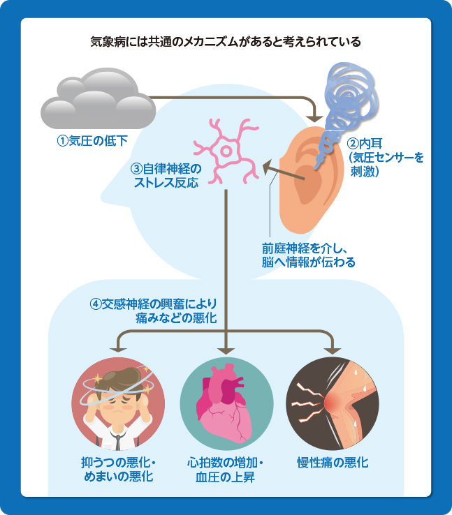 気象病のストレス学説
